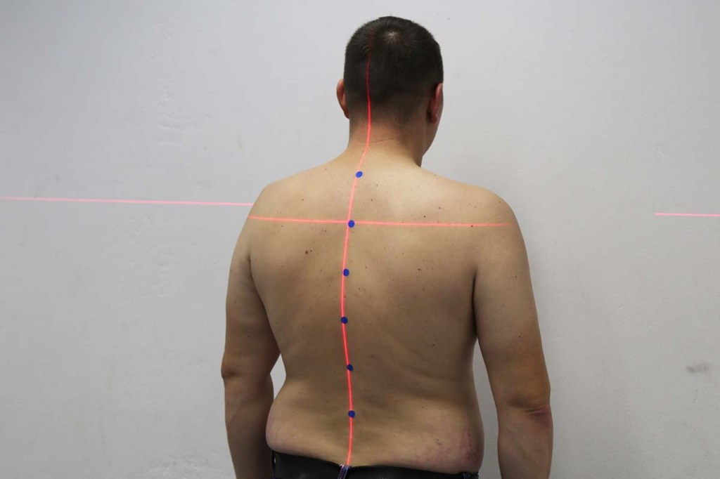 Nahaufnahme Person von hinten mit freiem Oberkörper, dessen Rücken per Laser vermessen wird